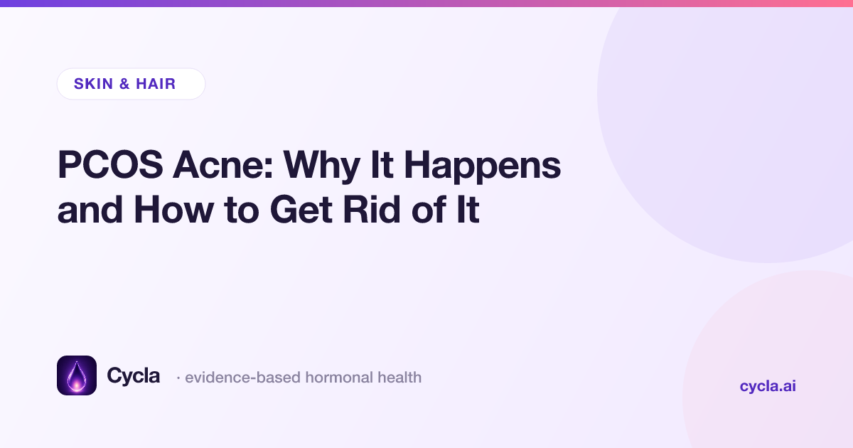 PCOS Acne: Why It Happens and How to Get Rid of It